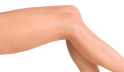 Abbildung: Beine Fettabsaugung